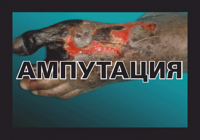 Минздрав опубликовал картинки для запугивания курильщиков