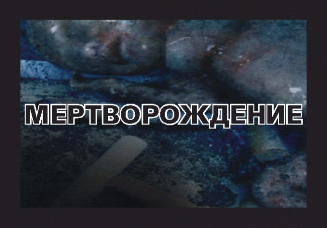 Минздрав опубликовал картинки для запугивания курильщиков