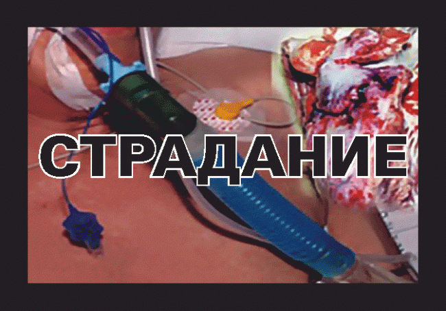 Минздрав опубликовал картинки для запугивания курильщиков