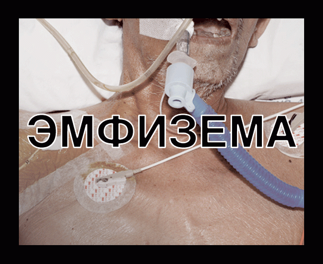 Минздрав опубликовал картинки для запугивания курильщиков