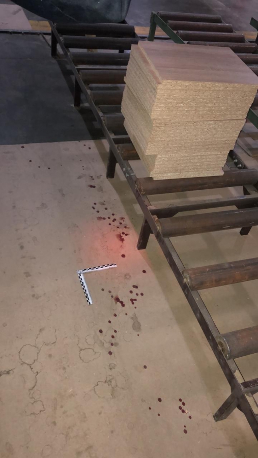 Под Саратовом работник мебельного цеха случайно отпилил себе кисть руки