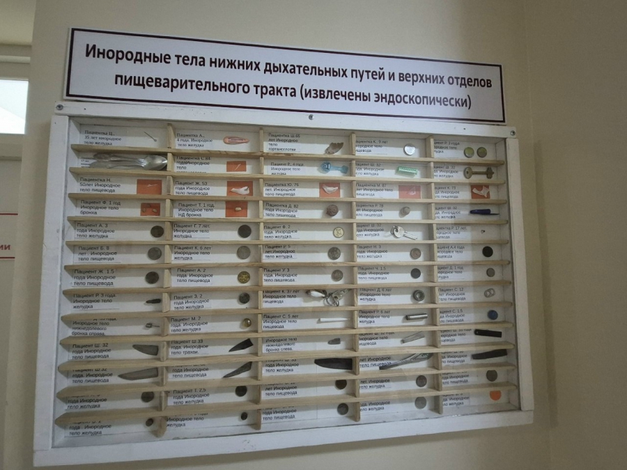 В Балакове девушка проглотила пирсинг во время еды и оказалась в больнице