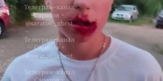 На жителя Шумейки завели дело о хулиганстве после жестокого избиения подростка На жителя Шумейки завели дело о хулиганстве после жестокого избиения подростка
