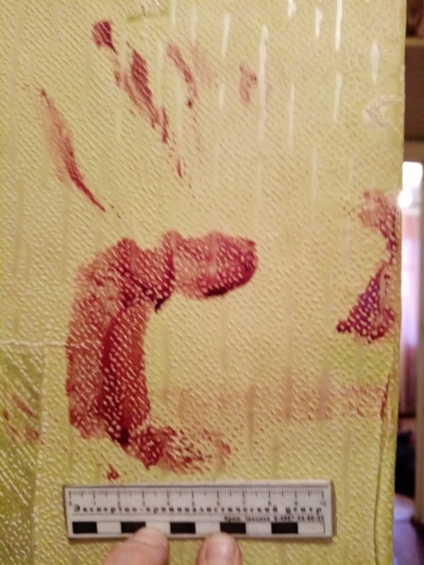 Сельчанка при самообороне проткнула ножом горло мужчине