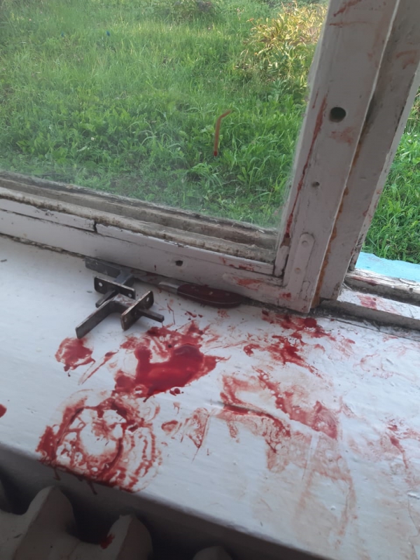 Сельчанка при самообороне проткнула ножом горло мужчине