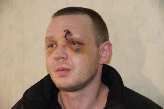 Саратовец обокрал сотрудников больницы, кафе и сауны