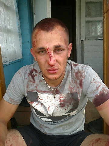 Депутата и его помощников обвиняют в избиении рабочего