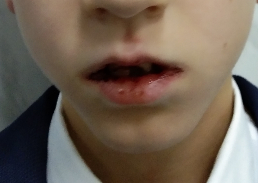 В Юбилейном начали проверку из-за жестокого избиения ученика 2-го класса в лицее