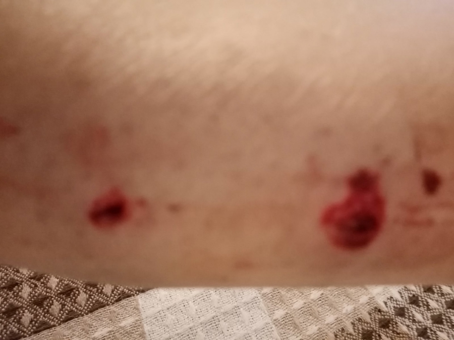 В Шарковке стая бродячих собак набросилась на прохожую