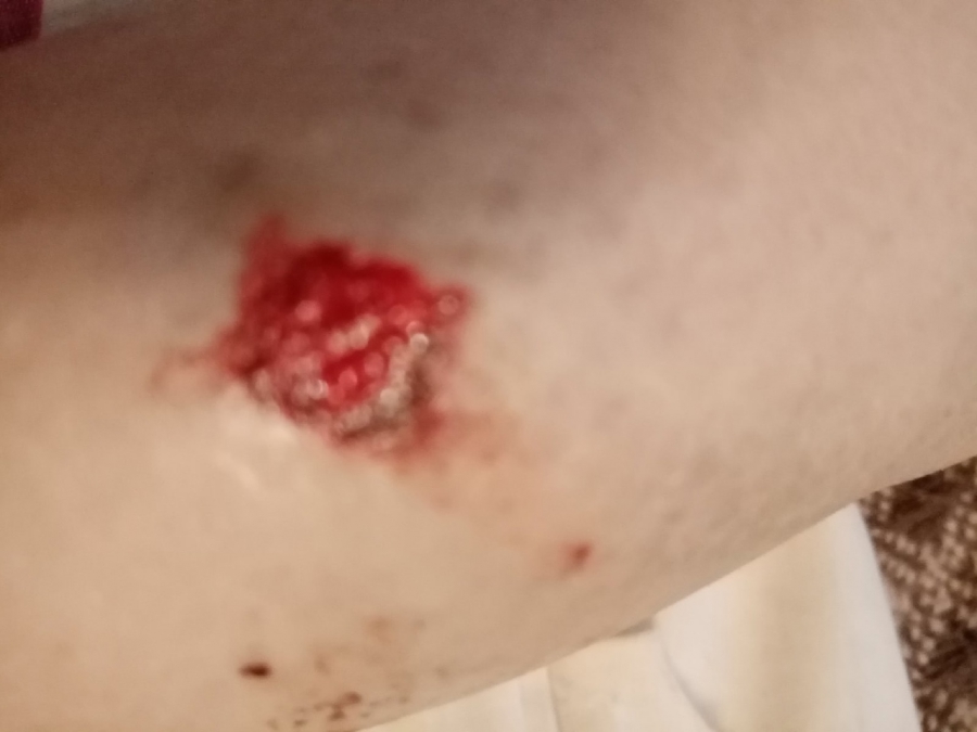 В Шарковке стая бродячих собак набросилась на прохожую