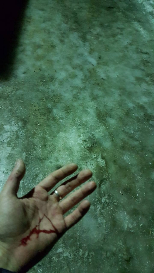 Саратовец получил сотрясение мозга после падения на льду во дворе многоэтажки