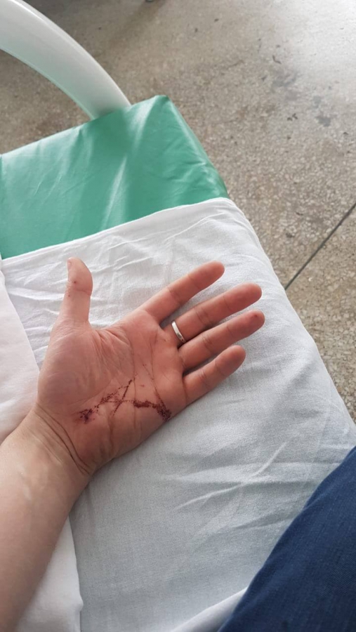 Саратовец получил сотрясение мозга после падения на льду во дворе многоэтажки