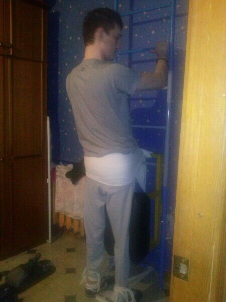 Попавшему в ДТП саратовцу требуется помощь