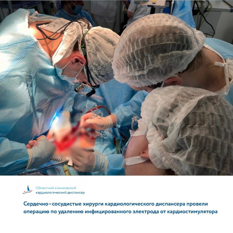 Медики удалили инфицированный электрод саратовчанке с кардиостимулятором