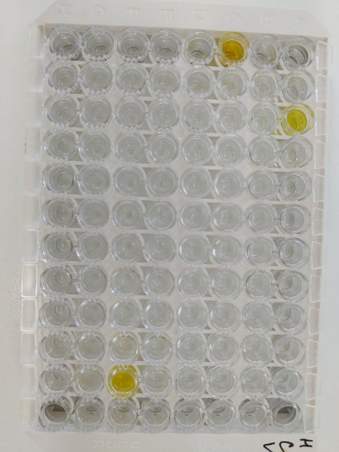 В поликлинике Юбилейного появился аппарат для проверки на кальцитонин и тестостерон