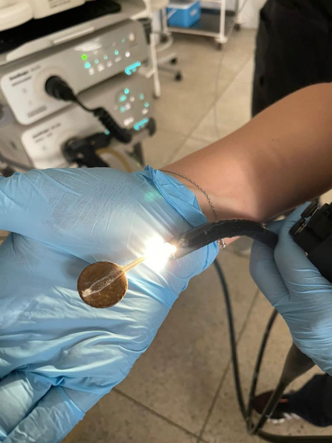 В Энгельсе врачи достали из желудка младенца рублевую монету