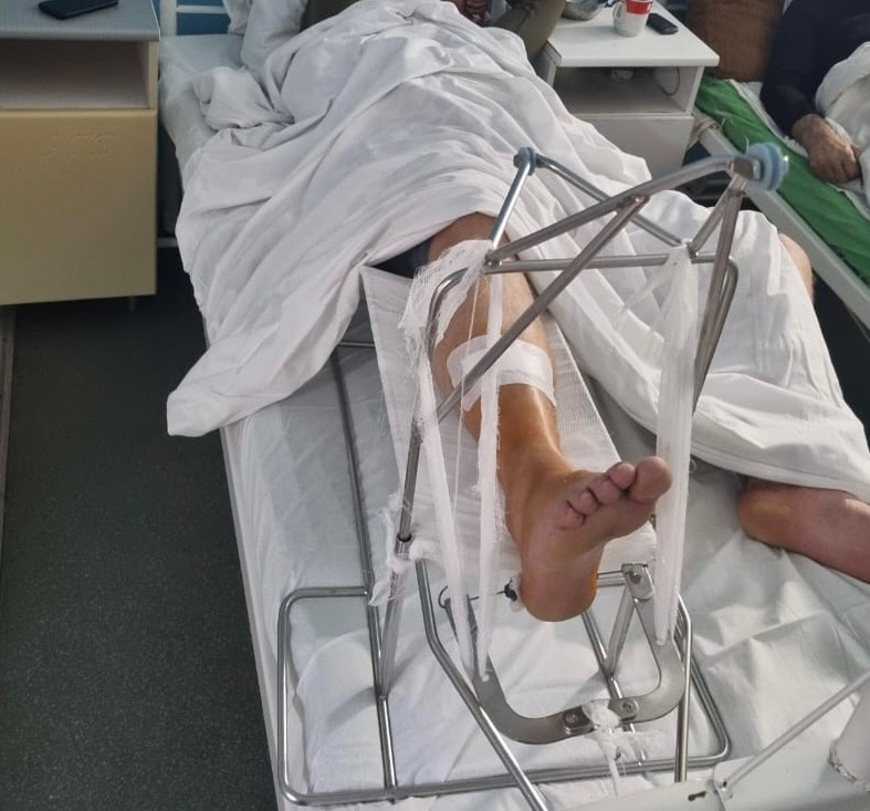 Гололед. Саратовец поскользнулся у стадиона «Волга» и сломал ногу