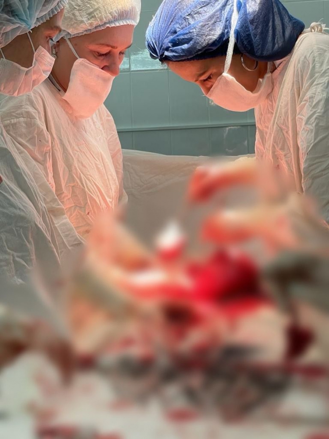 У саратовчанки обнаружили сразу две беременности: ей провели редкую операцию