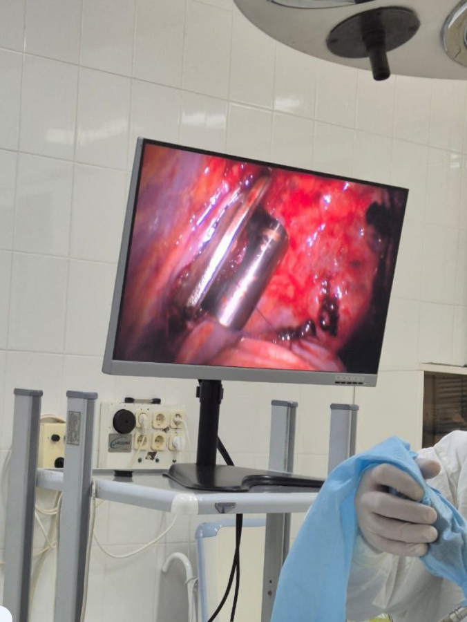 В Балакове подростки возле елки ранили мужчину ножом. Он терпел боль три дня