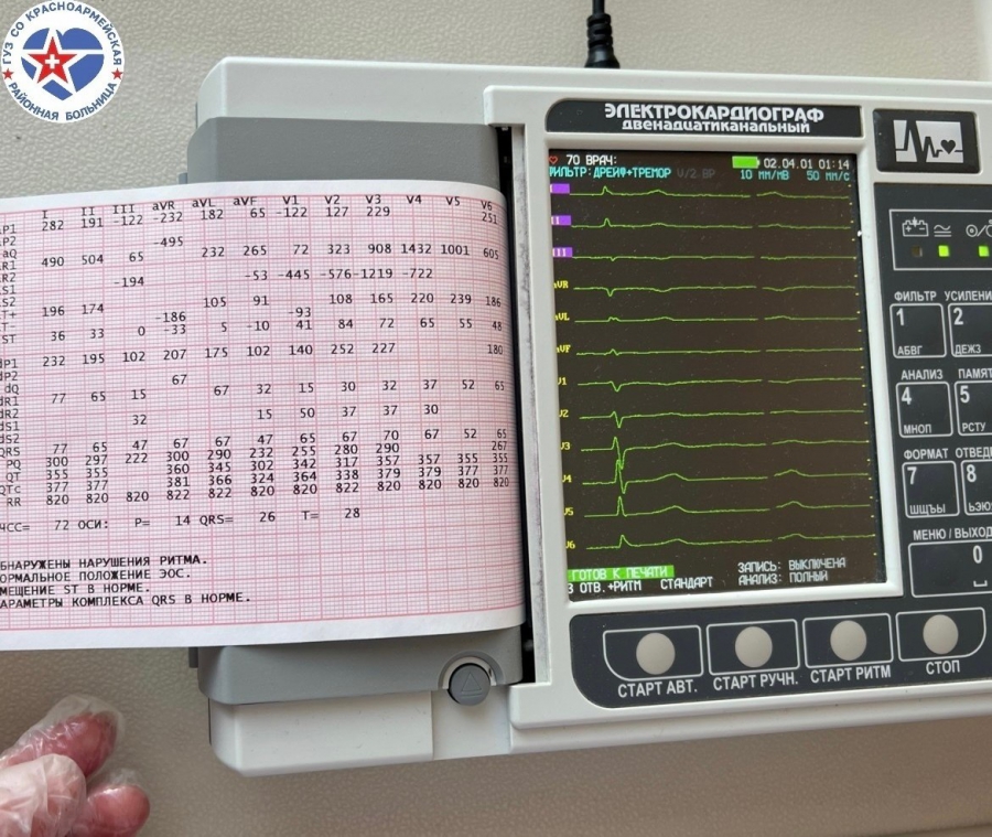 В Красноармейской больнице аппарат ЭКГ помогает вовремя выявлять патологии