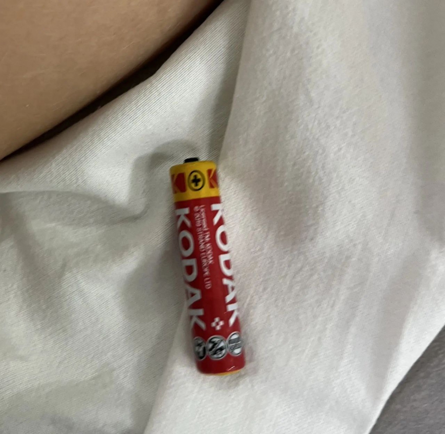 В Балакове врачи спасли двоих мальчиков с проглоченными батарейками