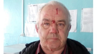 Пенсионер пожаловался в полицию на нападение депутата