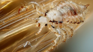 В Саратове вшивых больше, чем в других районах области В Саратове вшивых больше, чем в других районах области