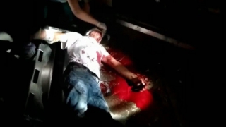 В Саратове мужчина сорвался с балкона и упал на козырек помещения МЧС