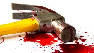 В Балакове молодому мужчине проломили череп молотком В Балакове молодому мужчине проломили череп молотком