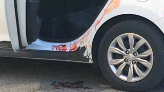 На саратовца завели дело о нападении с ножом на пассажирку такси