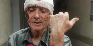 � ����������� ������ ������ ������� ��-�� ������� � ���� 17 �����