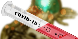 � �� ������� ��������� ����� ���������� COVID � ��� 19 768 �������