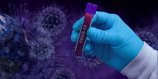 За сутки от коронавируса умерли 7 саратовцев от 32 до 83 лет За сутки от коронавируса умерли 7 саратовцев от 32 до 83 лет