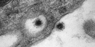 Ученые впервые опубликовали фото дельта-штамма коронавируса Ученые впервые опубликовали фото дельта-штамма коронавируса