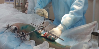 В Балакове провели сложнейшую операцию больному COVID со множеством переломов В Балакове провели сложнейшую операцию больному COVID со множеством переломов