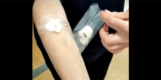 В Балакове медсестру поликлиники накажут за использование скотча вместо пластыря
