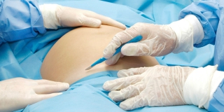 В Балакове 19-летняя беременная впала в кому. Медики спасают ее и сына В Балакове 19-летняя беременная впала в кому. Медики спасают ее и сына