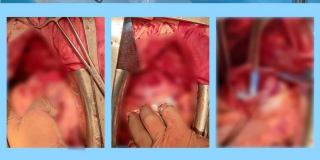 ����������� ������� �������������� �������� � ���������� ���������� � ������