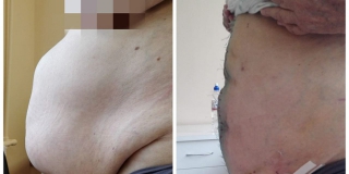 ����������� ����� ������� �� ������� ������� ������� ����� � 20 ��