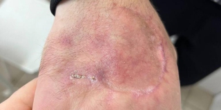 ����������� ����� ������� � �������� ���������� 15-������ �������