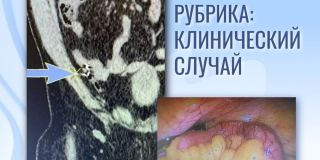 ����������� ������� ����� � �������� ����� �������� ���� � ������