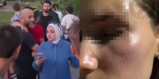 � �������� ������� ���������� � ����������� ��-�� ��������� �� 15-������ �������