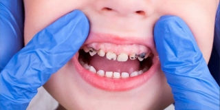 ����������� ����� ������ ����� 4-������� �������� � ������� ��������