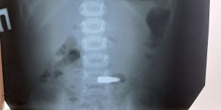 � �������� ������� ��������� ���� �� ����������� � ����� � ��������