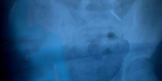 � �������� 11-������ ������� ��������� ����� �������