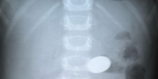 � �������� ����� ������ ������� � 10-�������� ������� � �������