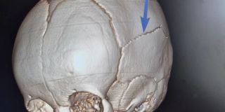 ������ ��������� ����������� � ������� ����� ������������� ������� � ��������