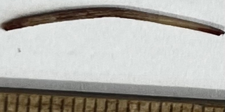 Саратовские врачи спустя два года извлекли из живота мужчины рыбную кость Саратовские врачи спустя два года извлекли из живота мужчины рыбную кость